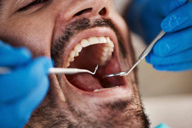 Best Emergency Dental Care for Trauma or Injury in Canby, MN
