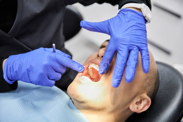 Best Emergency Tooth Extraction in Canby, MN